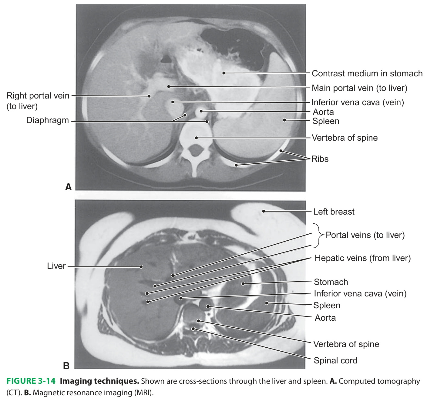 مقایسه CT و MRI