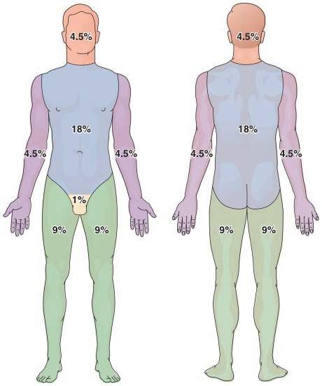 Rule of nines برای ارزیابی سوختگی
